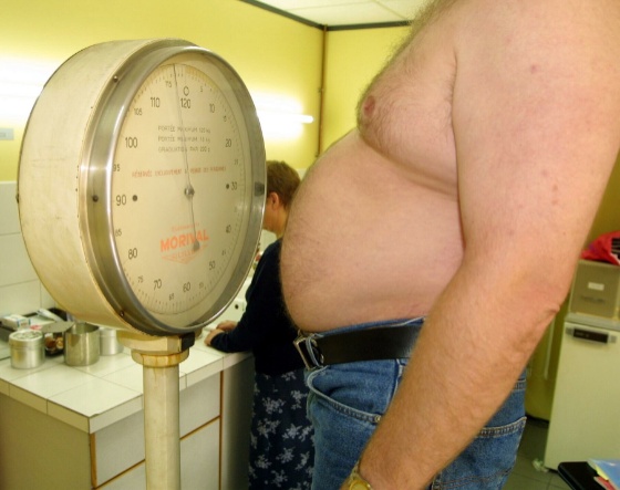 overvekt.jpg (Bredde: 560px) overvekt.jpg (Bredde: 560px)