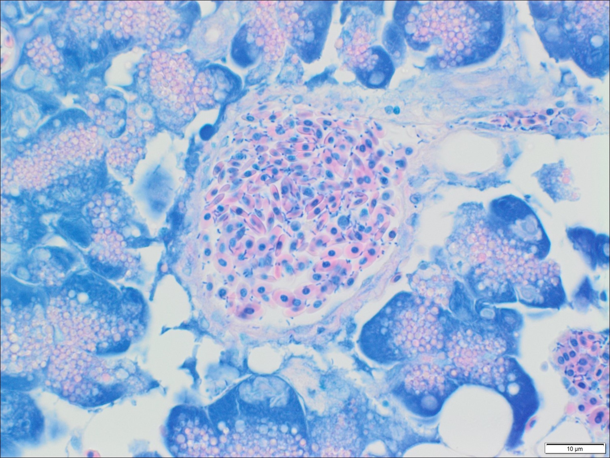 Blodkar fra rognskjeks med stavbakterier.jpg syk fisk leppefisk bakterier
