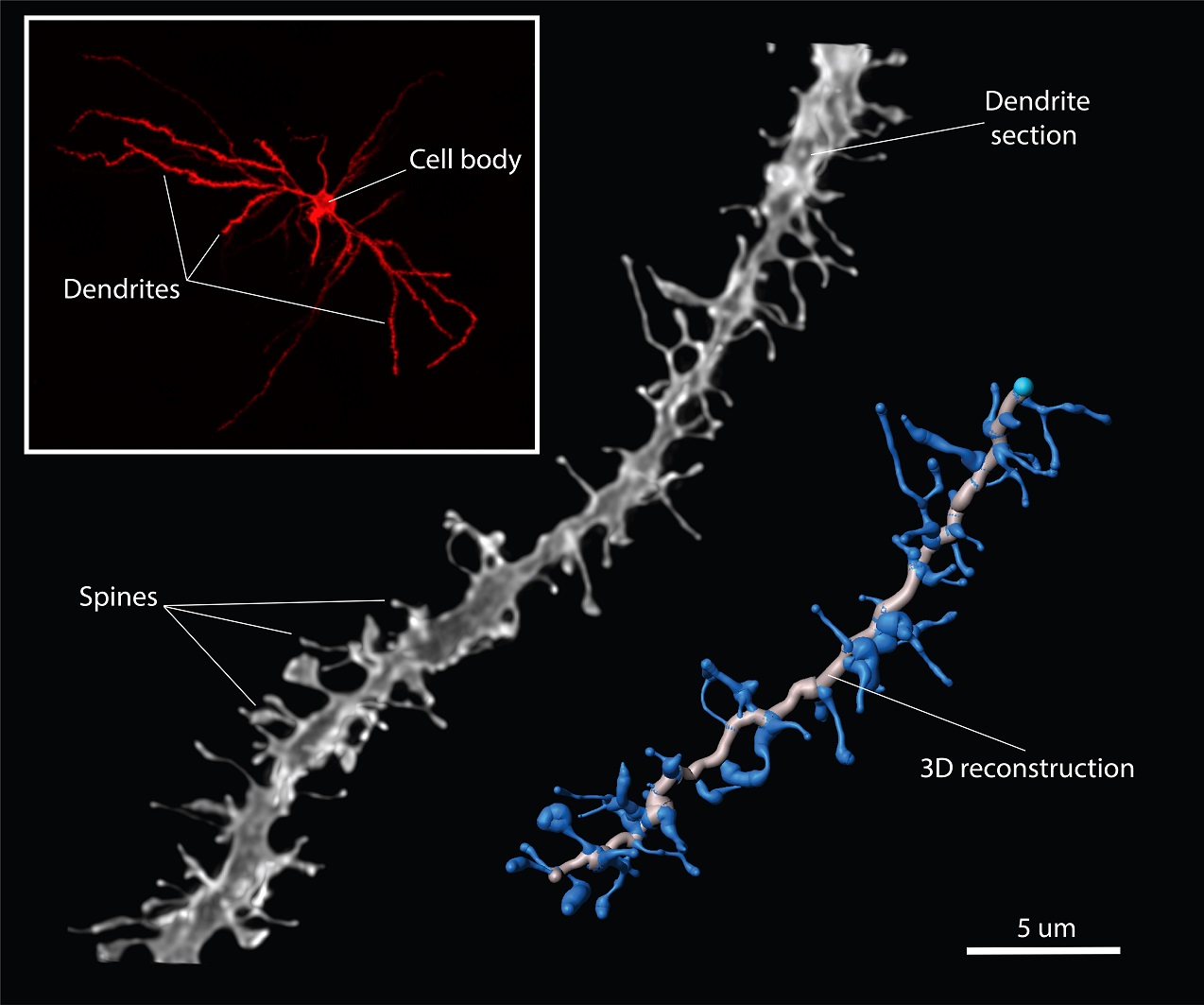 The structure of a neuron. A complete neuron with cell body and multiple dendrites filled with red dye in the top left. A magnification of a section of a dendrite with a lot of spines visible. And a 3D reconstruction of the middle part of the dendrite section.