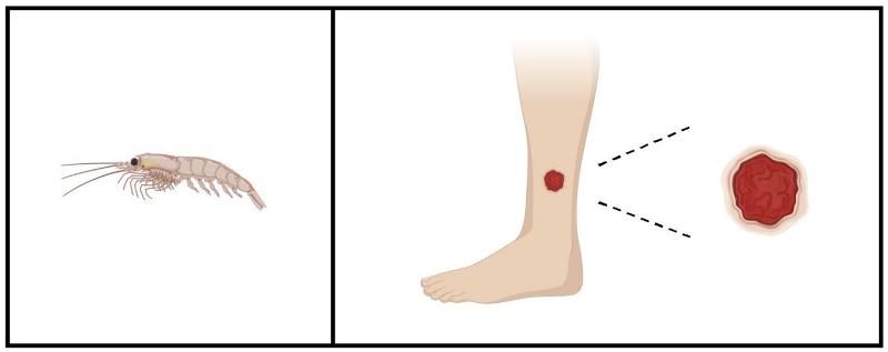 Figur med reke og s&aring;r.