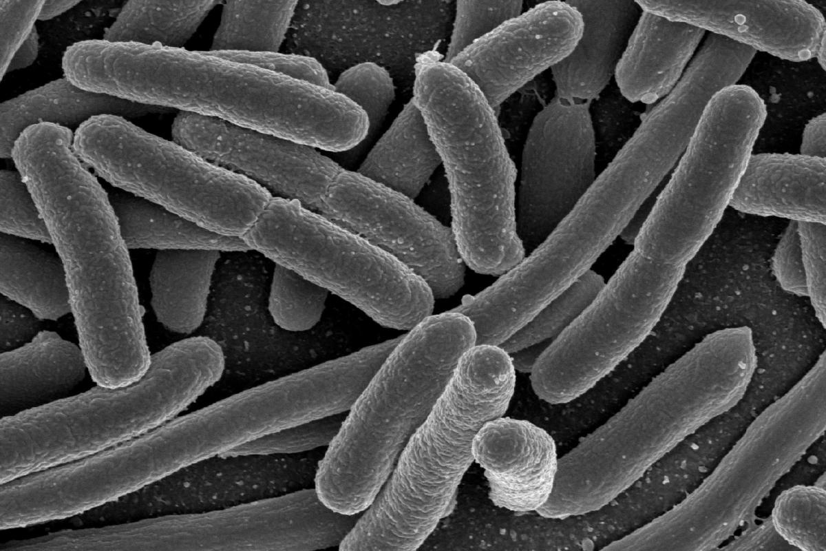 mikroskopbilete av e.coli-bakteriar