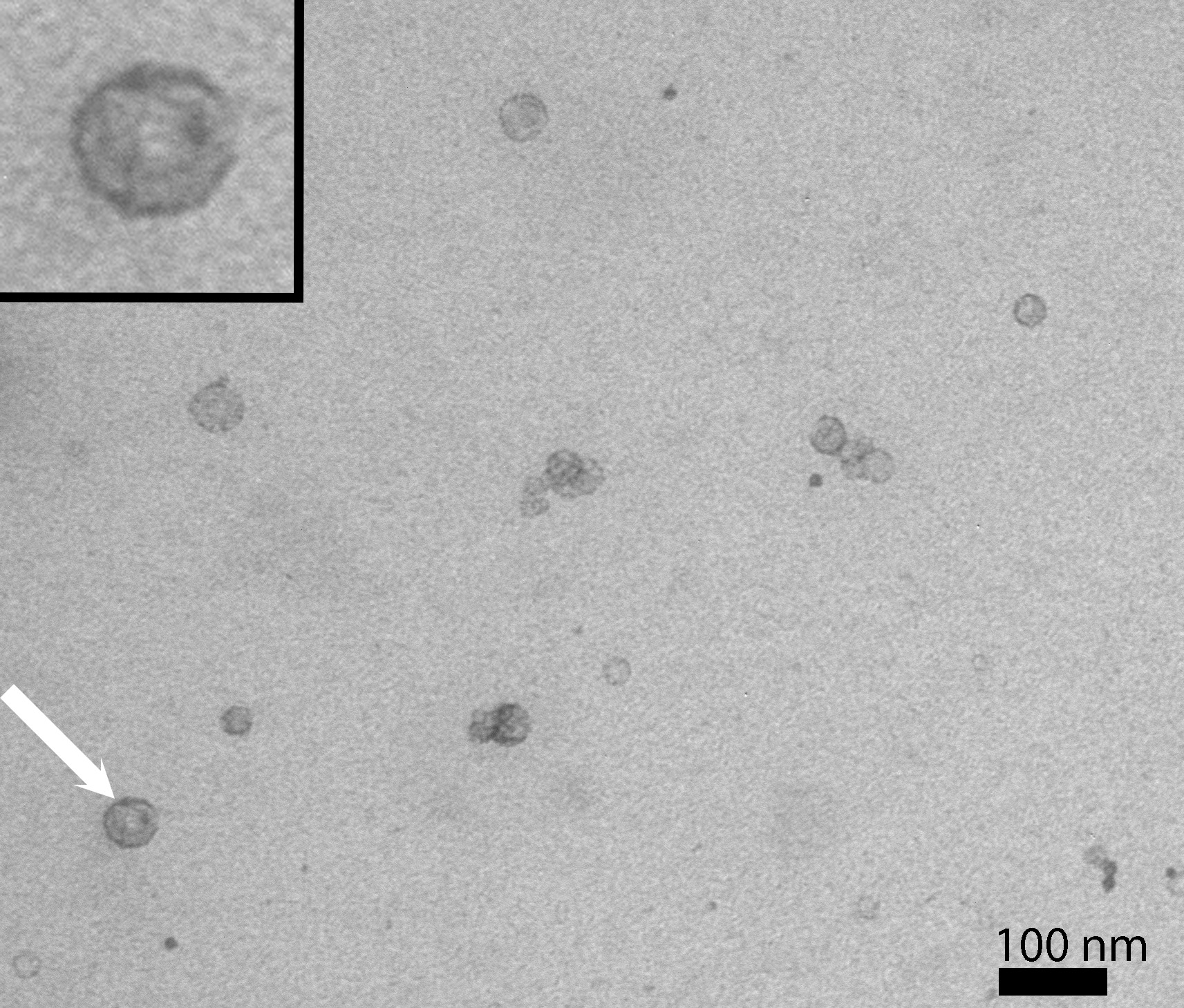 membranvesikler (1)-1.jpg