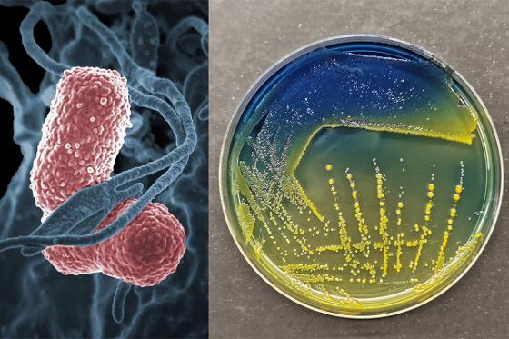 Klebsiella_elektronmikrograf_petriskål_1200px.jpg