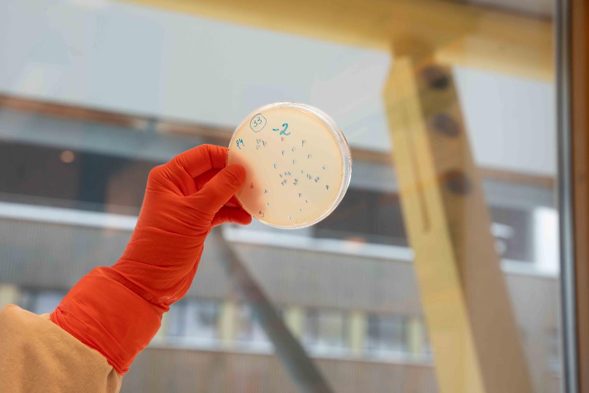 Bilde av en agarplate som holdes opp i et laboratorium